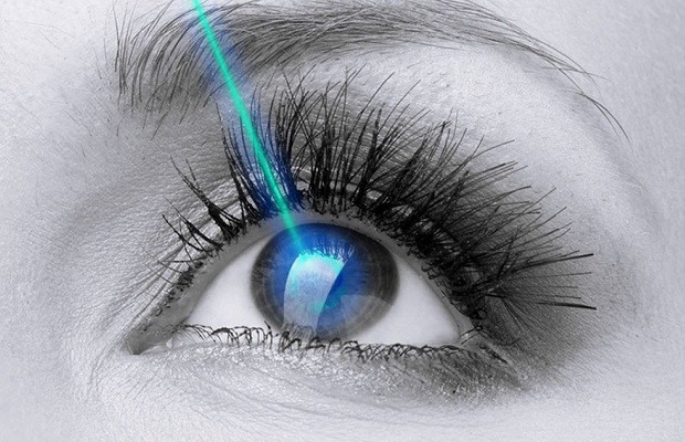 Mắt cận thị nên uống thuốc gì - phẫu thuật chữa cận 
