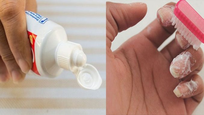 7 công dụng làm đẹp của kem đánh răng - Làm sạch móng tay