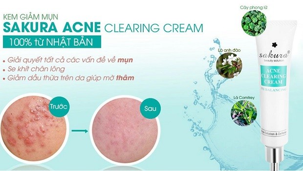 review kem trị mụn tốt cho da dầu -  Sakura Acne Clearing Cream
