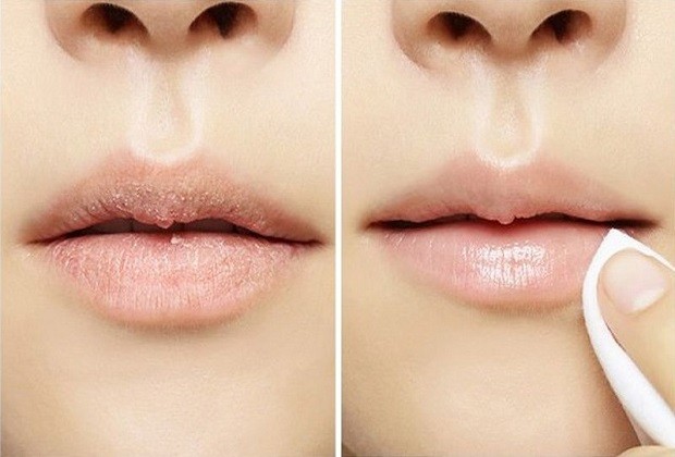 cách làm môi nhỏ lại như thế nào