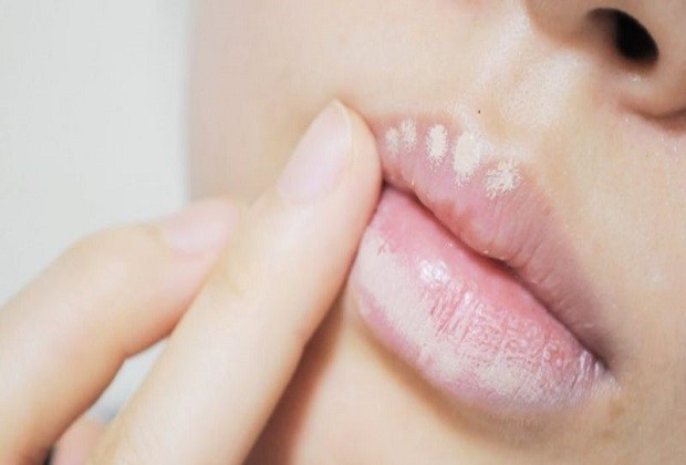 cách làm môi nhỏ lại - che khuyết điểm