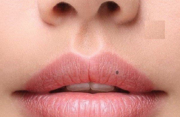 nốt ruồi ở môi trên bên trái phụ nữ